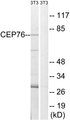 CEP76 Antibody - Western blot analysis of lysates from NIH/3T3 cells, using CEP76 Antibody. The lane on the right is blocked with the synthesized peptide.