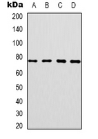 CEP76 Antibody - Western blot analysis of CEP76 expression in SKOV3 (A); HT29 (B); HepG2 (C); NIH3T3 (D) whole cell lysates.