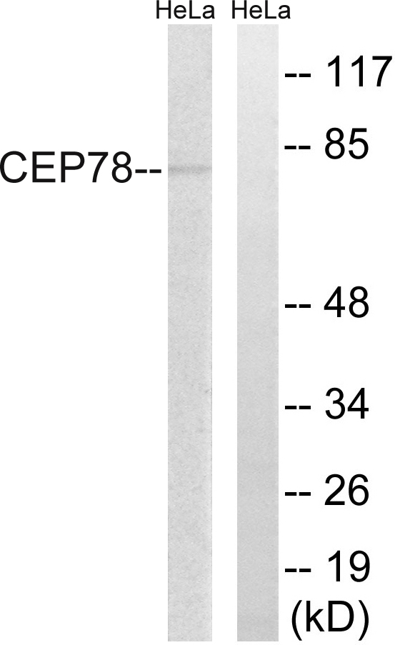 CEP78 / IP63 Antibody - Western blot analysis of lysates from HeLa cells, using CEP78 Antibody. The lane on the right is blocked with the synthesized peptide.