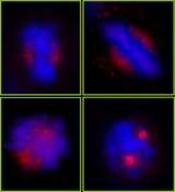 CEP78 / IP63 Antibody - Detection of Human CEP78 by Immunocytochemistry. Sample: NBF-fixed asynchronous HeLa cells. Antibody: Affinity purified rabbit anti-CEP78 used at a dilution of 1:250. Detection: Red-fluorescent goat anti-rabbit IgG highly cross-adsorbed Antibody Hilyte Plus 555 (A120-501E) used at a dilution of 1:100.