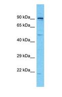 CEP78 / IP63 Antibody - Western blot of CEP78 Antibody with THP-1 Whole Cell lysate.  This image was taken for the unconjugated form of this product. Other forms have not been tested.