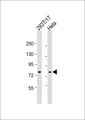 CEP78 / IP63 Antibody - All lanes: Anti-CEP78 Antibody at 1:1000 dilution. Lane 1: 293T/17 whole cell lysate. Lane 2: HeLa whole cell lysate Lysates/proteins at 20 ug per lane. Secondary Goat Anti-Rabbit IgG, (H+L), Peroxidase conjugated at 1:10000 dilution. Predicted band size: 76 kDa. Blocking/Dilution buffer: 5% NFDM/TBST.
