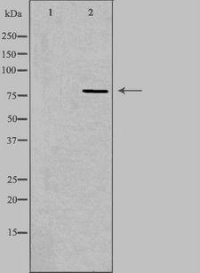 CEP78 / IP63 Antibody - Western blot analysis of extracts of HeLa cells using CEP78 antibody. The lane on the left is treated with the antigen-specific peptide.