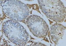 CEP78 / IP63 Antibody - 1:100 staining mouse testis tissue by IHC-P. The sample was formaldehyde fixed and a heat mediated antigen retrieval step in citrate buffer was performed. The sample was then blocked and incubated with the antibody for 1.5 hours at 22°C. An HRP conjugated goat anti-rabbit antibody was used as the secondary.