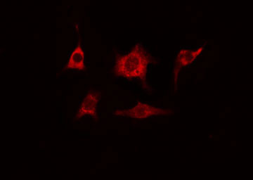 CEP78 / IP63 Antibody - Staining HeLa cells by IF/ICC. The samples were fixed with PFA and permeabilized in 0.1% Triton X-100, then blocked in 10% serum for 45 min at 25°C. The primary antibody was diluted at 1:200 and incubated with the sample for 1 hour at 37°C. An Alexa Fluor 594 conjugated goat anti-rabbit IgG (H+L) antibody, diluted at 1/600, was used as secondary antibody.