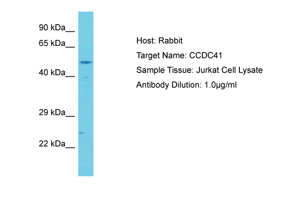 CEP83 / CCDC41 Antibody -  This image was taken for the unconjugated form of this product. Other forms have not been tested.