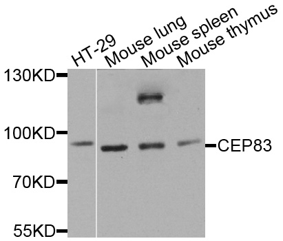 CEP83 / CCDC41 Antibody - Western blot analysis of extracts of various cells.