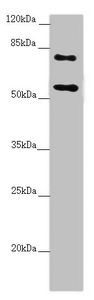CEP83 / CCDC41 Antibody - Western blot All Lanes:CEP83 antibody at 2.41 ug/ml+ Raji whole cell lysate Secondary Goat polyclonal to rabbit IgG at 1/10000 dilution Predicted band size: 83,68 kDa Observed band size: 82,55 kDa
