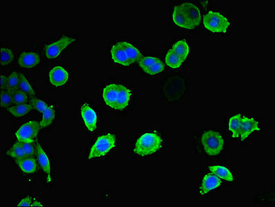 CEP83 / CCDC41 Antibody - Immunofluorescent analysis of PC3 cells diluted at 1:100 and Alexa Fluor 488-congugated AffiniPure Goat Anti-Rabbit IgG(H+L)