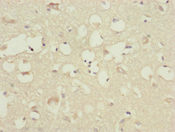 CEP83 / CCDC41 Antibody - Immunohistochemistry of paraffin-embedded human brain tissue at dilution of 1:100
