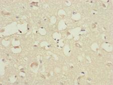 CEP83 / CCDC41 Antibody - Immunohistochemistry of paraffin-embedded human brain tissue at dilution of 1:100