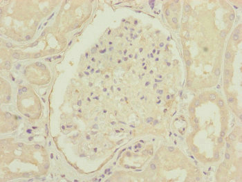 CEP83 / CCDC41 Antibody - Immunohistochemistry of paraffin-embedded human kidney tissue at dilution of 1:100