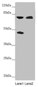 CEP83 / CCDC41 Antibody - Western blot All Lanes:CEP83 antibody at 2.27 ug/ml Lane 1: Mouse liver tissue Lane 2: COLO205 whole cell lysate Secondary Goat polyclonal to rabbit IgG at 1/10000 dilution Predicted band size: 83,68 kDa Observed band size: 82,45 kDa