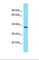 CEP89 Antibody - Western blot of Human OVCAR-3. CEP89 antibody dilution 1.0 ug/ml.  This image was taken for the unconjugated form of this product. Other forms have not been tested.
