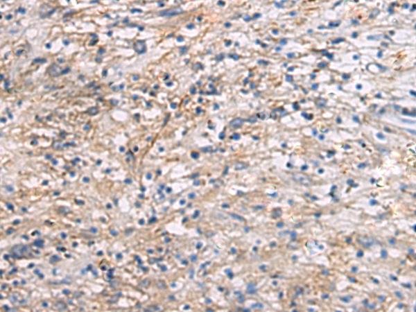 CEP89 Antibody - Immunohistochemistry of paraffin-embedded Human brain tissue  using CEP89 Polyclonal Antibody at dilution of 1:95(×200)