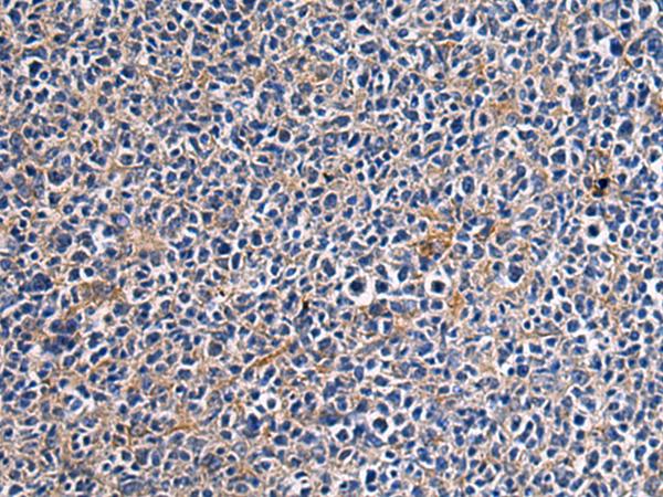 CEP89 Antibody - Immunohistochemistry of paraffin-embedded Human tonsil tissue  using CEP89 Polyclonal Antibody at dilution of 1:95(×200)