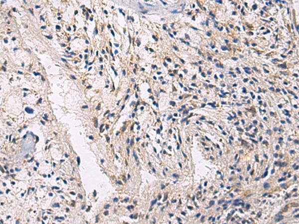 CEP89 Antibody - Immunohistochemistry of paraffin-embedded Human brain tissue  using CEP89 Polyclonal Antibody at dilution of 1:100(×200)