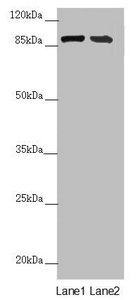 CEP95 / CCDC45 Antibody - Western blot All Lanes:CEP95 antibody at 6.06 ug/ml Lane 1: Mouse heart tissue Lane 2: Mouse kidney tissue Secondary Goat polyclonal to rabbit IgG at 1/10000 dilution Predicted band size: 96,77 kDa Observed band size: 95 kDa