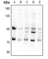 CEP95 / CCDC45 Antibody - Western blot analysis of CEP95 expression in CT26 (A), PC12 (B), A549 (C), HEK293T (D), LO2 (E) whole cell lysates.