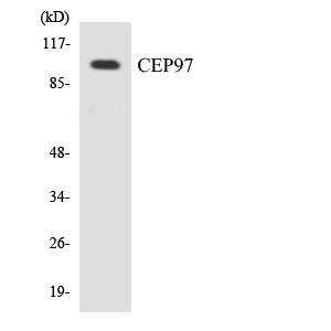 CEP97 Antibody - Western blot analysis of the lysates from COLO205 cells using CEP97 antibody.