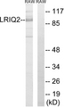 CEP97 Antibody - Western blot analysis of lysates from RAW264.7 cells, using CEP97 Antibody. The lane on the right is blocked with the synthesized peptide.