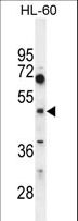 CEPT1 Antibody - CEPT1 Antibody western blot of HL60 cell line lysates (35 ug/lane). The CEPT1 antibody detected the CEPT1 protein (arrow).