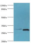 CER1 Antibody - Western blot. All lanes: Cerberus antibody at 2 ug/ml. Lane 1: HeLa whole cell lysate. Lane 2: Rat kidney tissue. Secondary antibody: Goat polyclonal to rabbit at 1:10000 dilution. Predicted band size: 30 kDa. Observed band size: 30 kDa.