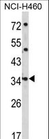 CER1 Antibody - Western blot of CER1 Antibody in NCI-H460 cell line lysates (35 ug/lane). CER1 (arrow) was detected using the purified antibody.