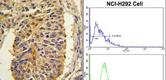 CER1 Antibody - (LEFT)Formalin-fixed and paraffin-embedded human lung carcinoma with CER1 Antibody , which was peroxidase-conjugated to the secondary antibody, followed by DAB staining. This data demonstrates the use of this antibody for immunohistochemistry; clinical relevance has not been evaluated. (RIGHT)Flow cytometric of NCI-H292 cells using CER1 Antibody (bottom histogram) compared to a negative control cell (top histogram). FITC-conjugated goat-anti-rabbit secondary antibodies were used for the analysis.