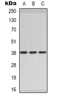 CER1 Antibody - Western blot analysis of CER1 expression in MCF7 (A); rat heart (B); rat brain (C) whole cell lysates.