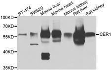 CER1 Antibody - Western blot analysis of extracts of various cell lines.