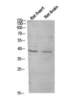 CER1 Antibody - Western blot analysis of extracts from MCF-7 cells, using CER1 Antibody.