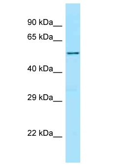 Ceramide Kinase / CERK Antibody - Ceramide Kinase / CERK antibody Western Blot of 721_B. Antibody dilution: 1 ug/ml.  This image was taken for the unconjugated form of this product. Other forms have not been tested.