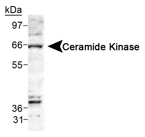 Ceramide Kinase / CERK Antibody - Detection of Ceramide Kinase in A549 cell lysate.  This image was taken for the unconjugated form of this product. Other forms have not been tested.