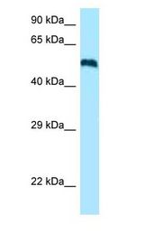 Ceramide Kinase / CERK Antibody - Ceramide Kinase / CERK antibody Western Blot of Fetal Brain.  This image was taken for the unconjugated form of this product. Other forms have not been tested.
