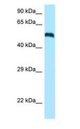 Ceramide Kinase / CERK Antibody - Ceramide Kinase / CERK antibody Western Blot of Fetal Brain.  This image was taken for the unconjugated form of this product. Other forms have not been tested.