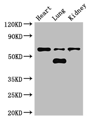 Ceramide Kinase / CERK Antibody - Positive WB detected in:Mouse heart tissue,Mouse lung tissue,Mouse kidney tissue;All lanes:CERK antibody at 3 ug/ml;Secondary;Goat polyclonal to rabbit IgG at 1/50000 dilution;Predicted band size: 60,38 kDa;Observed band size:60,48 kDa;