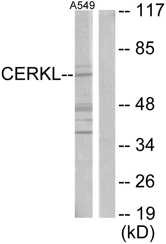 CERKL Antibody - Western blot analysis of lysates from A549 cells, using CERKL Antibody. The lane on the right is blocked with the synthesized peptide.