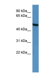 CERKL Antibody - CERKL antibody Western blot of Fetal Heart lysate.  This image was taken for the unconjugated form of this product. Other forms have not been tested.
