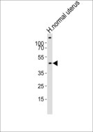 CERKL Antibody - Western blot of lysate from human normal uterus tissue lysate with CERKL Antibody. Antibody was diluted at 1:1000. A goat anti-rabbit IgG H&L (HRP) at 1:10000 dilution was used as the secondary antibody. Lysate at 20 ug.