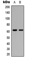 CERKL Antibody - Western blot analysis of CERKL expression in MCF7 (A); COLO205 (B) whole cell lysates.