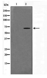 CERKL Antibody - Western blot of A549 cell lysate using CERKL Antibody