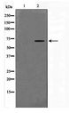 CERKL Antibody - Western blot of A549 cell lysate using CERKL Antibody