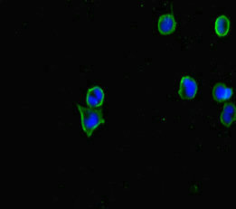 CERKL Antibody - Immunofluorescent analysis of MCF7 cells diluted at 1:100 and Alexa Fluor 488-congugated AffiniPure Goat Anti-Rabbit IgG(H+L)