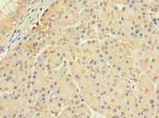 CERKL Antibody - Immunohistochemistry of paraffin-embedded human pancreatic tissue at dilution 1:100