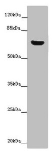 CERKL Antibody - Western blot All Lanes: CERKL antibody at 14 ug/ml+ Mouse lung tissue Secondary Goat polyclonal to rabbit IgG at 1/10000 dilution Predicted band size: 63,60,53,48,43,25,20,58 kDa Observed band size: 63 kDa