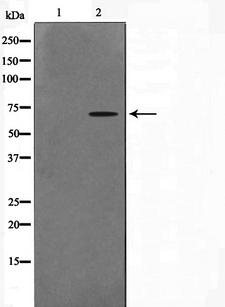 CERKL Antibody - Western blot analysis on A549 cell lysates using CERKL antibody. The lane on the left is treated with the antigen-specific peptide.
