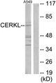 CERKL Antibody - Western blot analysis of extracts from A549 cells, using CERKL antibody.