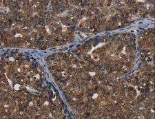 CerS6 / LASS6 Antibody - Immunohistochemistry of paraffin-embedded Human brain using CERS6 Polyclonal Antibody at dilution of 1:35.