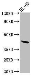CerS6 / LASS6 Antibody - Positive Western Blot detected in HL-60 whole cell lysate. All lanes: CERS6 antibody at 2.7 µg/ml Secondary Goat polyclonal to rabbit IgG at 1/50000 dilution. Predicted band size: 45, 46 KDa. Observed band size: 45 KDa